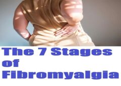 The 7 Stages of Fibromyalgia